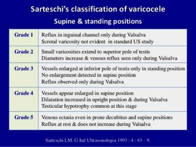 varicocele 1159